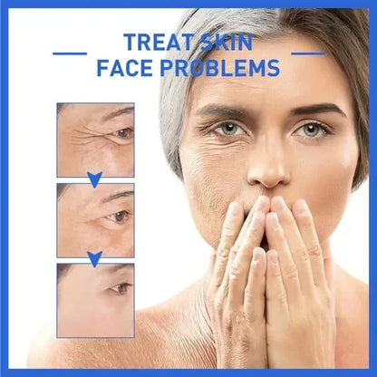 Botox Face Serum | Verwijdert Je Rimpels